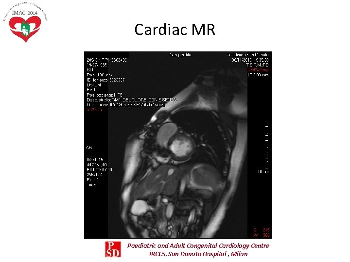 Cardiac MR Paediatric and Adult Congenital Cardiology Centre IRCCS, San Donato Hospital , Milan Cardiac MR Paediatric and Adult Congenital Cardiology Centre IRCCS, San Donato Hospital , Milan