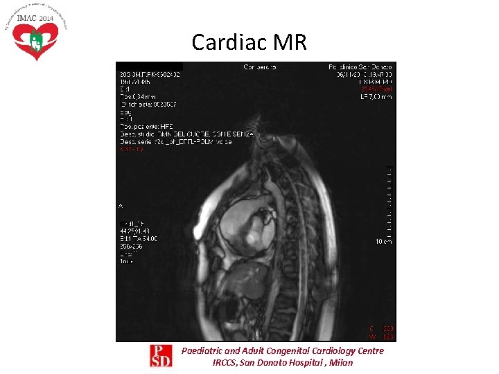Cardiac MR Paediatric and Adult Congenital Cardiology Centre IRCCS, San Donato Hospital , Milan Cardiac MR Paediatric and Adult Congenital Cardiology Centre IRCCS, San Donato Hospital , Milan