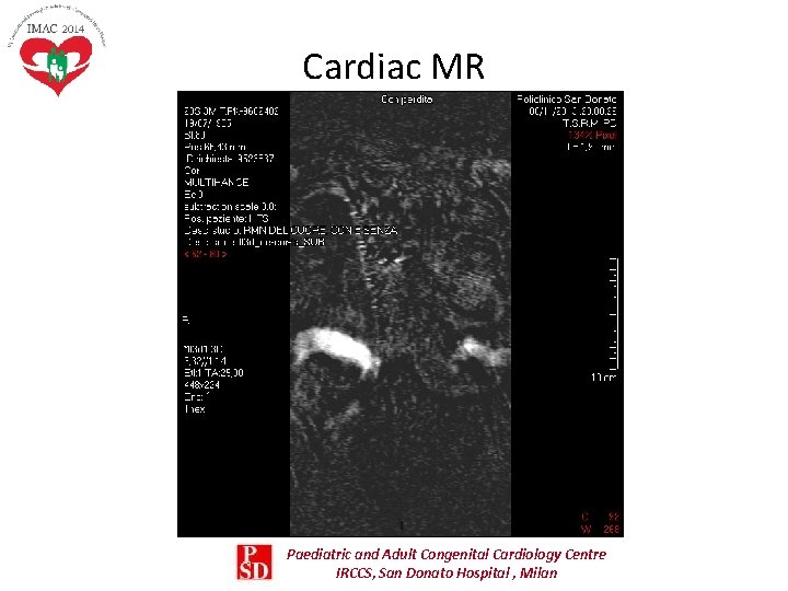 Cardiac MR Paediatric and Adult Congenital Cardiology Centre IRCCS, San Donato Hospital , Milan Cardiac MR Paediatric and Adult Congenital Cardiology Centre IRCCS, San Donato Hospital , Milan