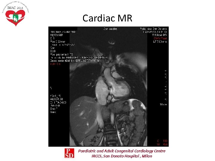 Cardiac MR Paediatric and Adult Congenital Cardiology Centre IRCCS, San Donato Hospital , Milan Cardiac MR Paediatric and Adult Congenital Cardiology Centre IRCCS, San Donato Hospital , Milan