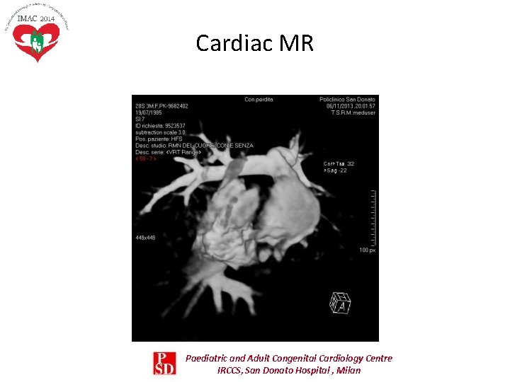 Cardiac MR Paediatric and Adult Congenital Cardiology Centre IRCCS, San Donato Hospital , Milan Cardiac MR Paediatric and Adult Congenital Cardiology Centre IRCCS, San Donato Hospital , Milan