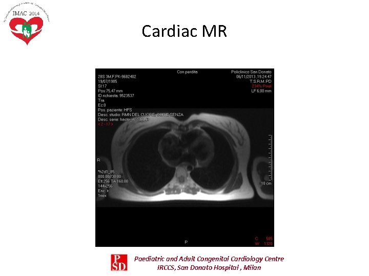 Cardiac MR Paediatric and Adult Congenital Cardiology Centre IRCCS, San Donato Hospital , Milan Cardiac MR Paediatric and Adult Congenital Cardiology Centre IRCCS, San Donato Hospital , Milan