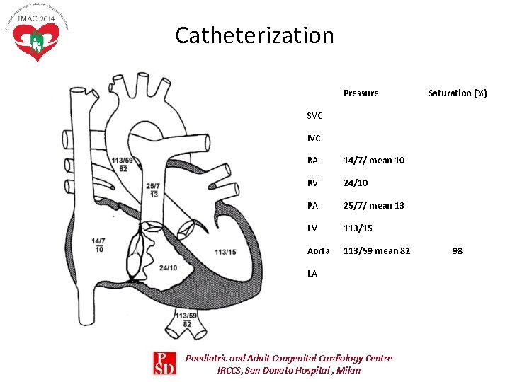 Catheterization Pressure Saturation (%) SVC IVC RA 14/7/ mean 10 RV 24/10 PA 25/7/ Catheterization Pressure Saturation (%) SVC IVC RA 14/7/ mean 10 RV 24/10 PA 25/7/