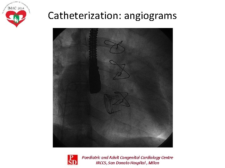 Catheterization: angiograms Paediatric and Adult Congenital Cardiology Centre IRCCS, San Donato Hospital , Milan Catheterization: angiograms Paediatric and Adult Congenital Cardiology Centre IRCCS, San Donato Hospital , Milan