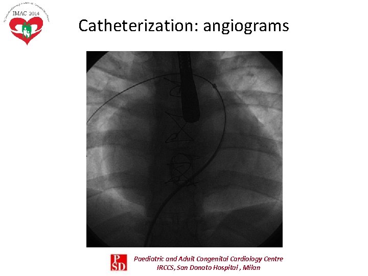 Catheterization: angiograms Paediatric and Adult Congenital Cardiology Centre IRCCS, San Donato Hospital , Milan Catheterization: angiograms Paediatric and Adult Congenital Cardiology Centre IRCCS, San Donato Hospital , Milan
