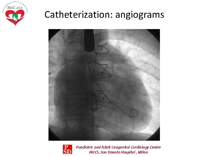 Catheterization: angiograms Paediatric and Adult Congenital Cardiology Centre IRCCS, San Donato Hospital , Milan Catheterization: angiograms Paediatric and Adult Congenital Cardiology Centre IRCCS, San Donato Hospital , Milan
