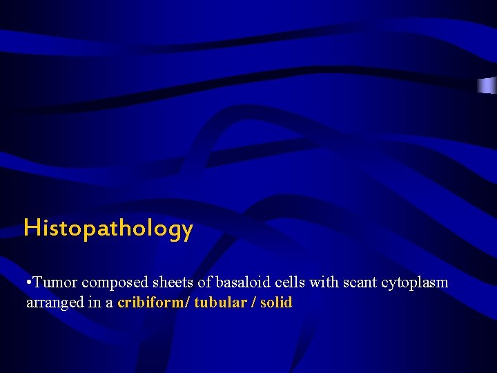 Histopathology • Tumor composed sheets of basaloid cells with scant cytoplasm arranged in a