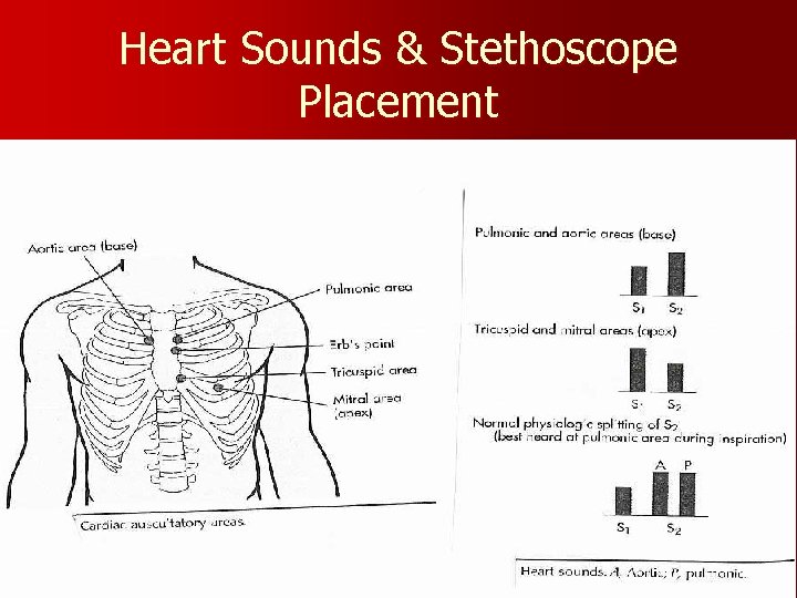 Heart Sounds & Stethoscope Placement 