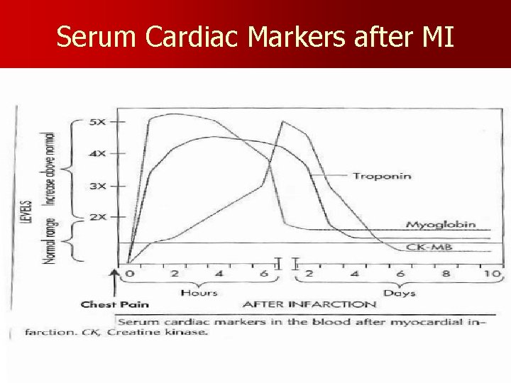 Serum Cardiac Markers after MI 