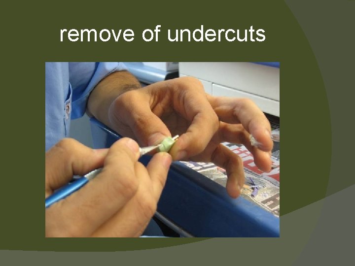 remove of undercuts 