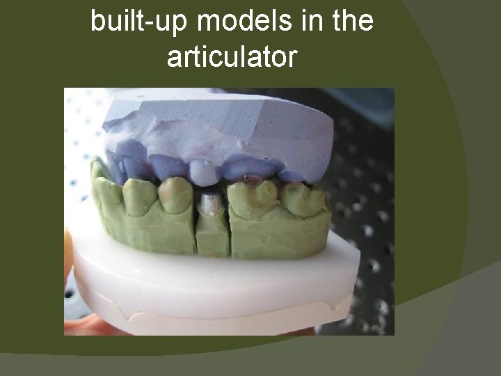 built-up models in the articulator 