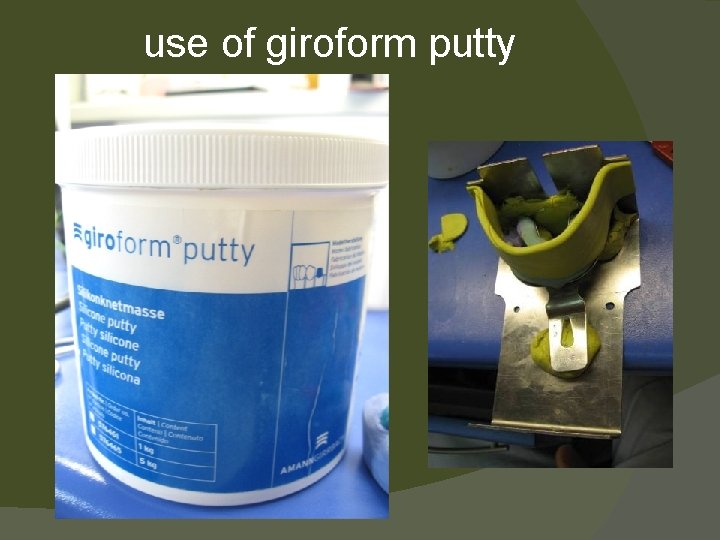 use of giroform putty 