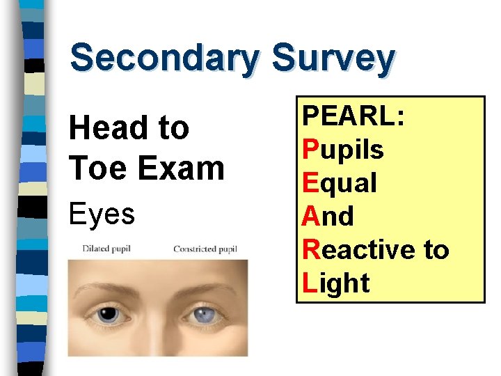 Secondary Survey Head to Toe Exam Eyes PEARL: Pupils Equal And Reactive to Light
