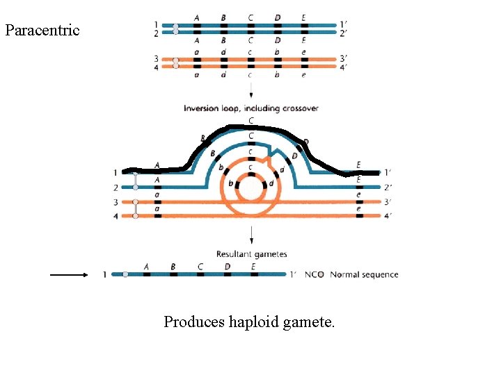 Paracentric Produces haploid gamete. 