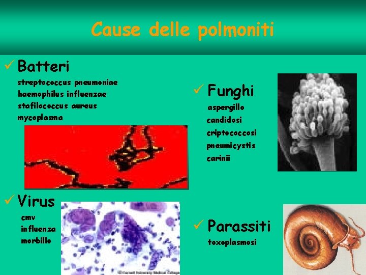 Cause delle polmoniti ü Batteri streptococcus pneumoniae haemophilus influenzae stafilococcus aureus mycoplasma ü Funghi