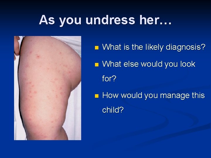As you undress her… n What is the likely diagnosis? n What else would