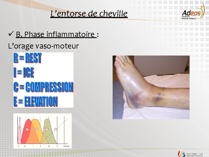 L’entorse de cheville ü B. Phase inflammatoire : L’orage vaso-moteur 