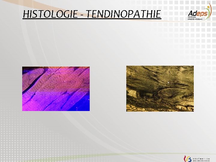 HISTOLOGIE - TENDINOPATHIE 