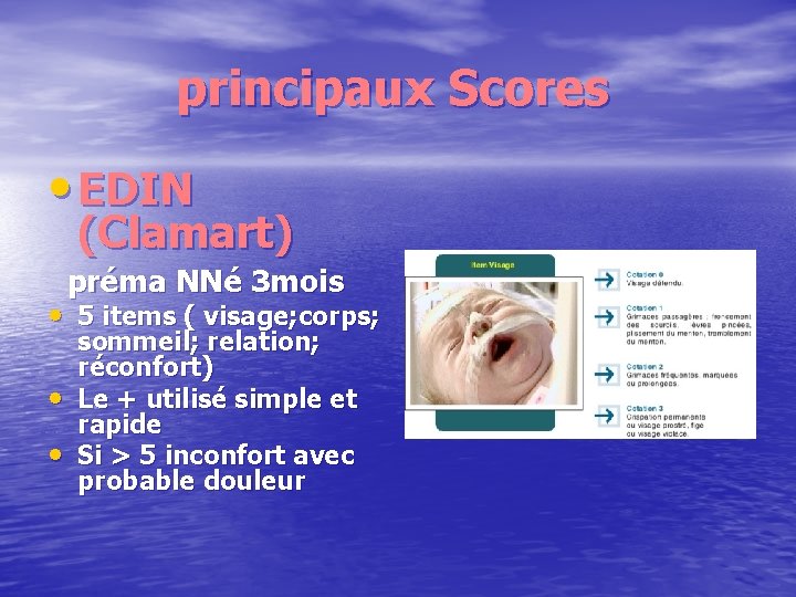 principaux Scores • EDIN (Clamart) préma NNé 3 mois • 5 items ( visage;