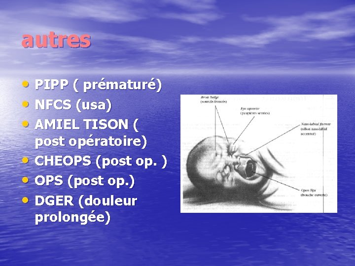 autres • PIPP ( prématuré) • NFCS (usa) • AMIEL TISON ( • •