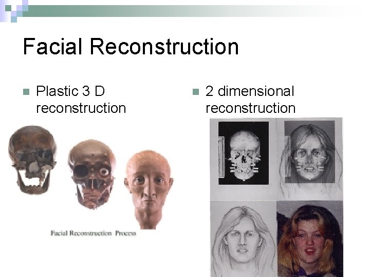 Facial Reconstruction n Plastic 3 D reconstruction n 2 dimensional reconstruction 