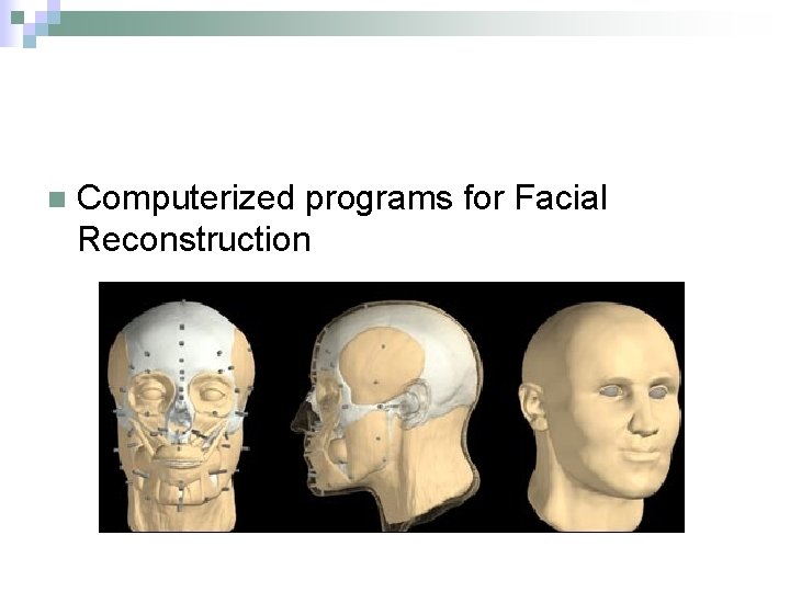 n Computerized programs for Facial Reconstruction 