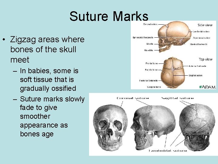 Suture Marks • Zigzag areas where bones of the skull meet – In babies,