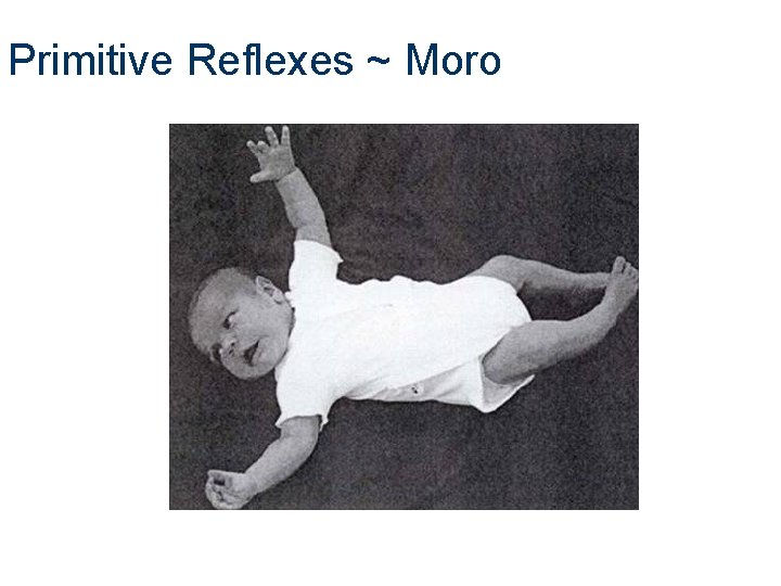 Primitive Reflexes ~ Moro Primitive Reflexes ~ Moro