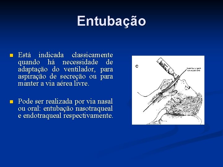 Entubação n Está indicada classicamente quando há necessidade de adaptação do ventilador, para aspiração