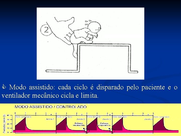  Modo assistido: cada ciclo é disparado pelo paciente e o ventilador mecânico cicla