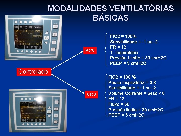 MODALIDADES VENTILATÓRIAS BÁSICAS PCV Controlado VCV Fi. O 2 = 100% Sensibilidade = -1