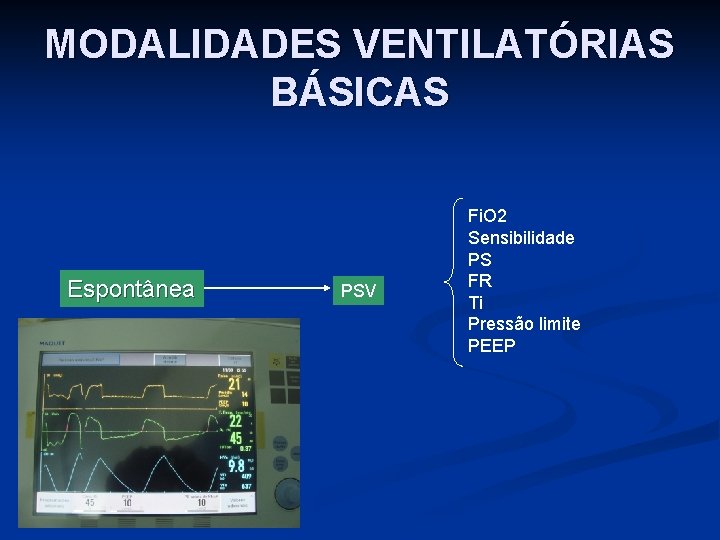 MODALIDADES VENTILATÓRIAS BÁSICAS Espontânea PSV Fi. O 2 Sensibilidade PS FR Ti Pressão limite