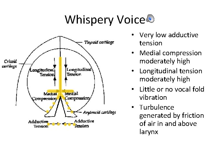 Whispery Voice • Very low adductive tension • Medial compression moderately high • Longitudinal