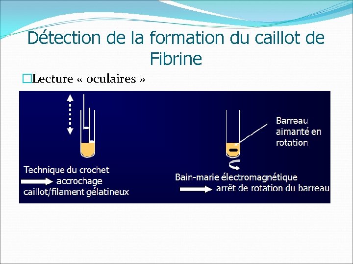 Détection de la formation du caillot de Fibrine �Lecture « oculaires » 