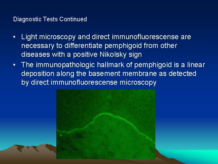 Diagnostic Tests Continued • Light microscopy and direct immunofluorescense are necessary to differentiate pemphigoid