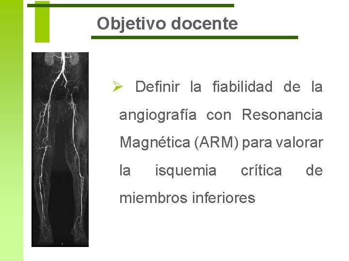 Objetivo docente Ø Definir la fiabilidad de la angiografía con Resonancia Magnética (ARM) para