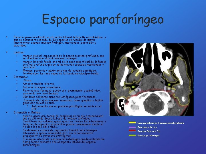 Espacio parafaríngeo • Espacio graso localizado en situación lateral del cuello suprahioideo, y que