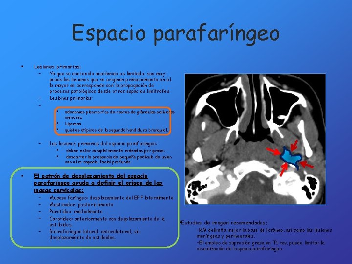 Espacio parafaríngeo • Lesiones primarias: – Ya que su contenido anatómico es limitado, son