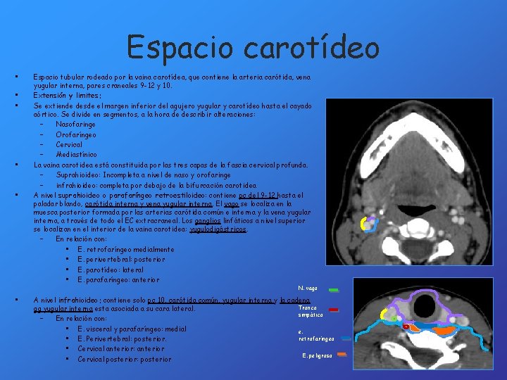Espacio carotídeo • • • Espacio tubular rodeado por la vaina carotídea, que contiene