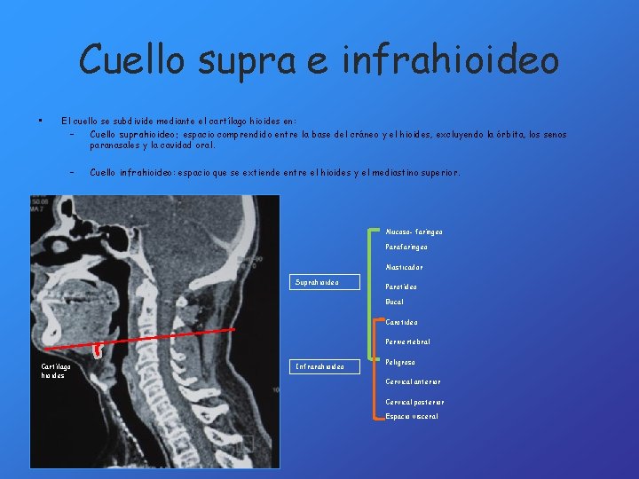 Cuello supra e infrahioideo • El cuello se subdivide mediante el cartílago hioides en: