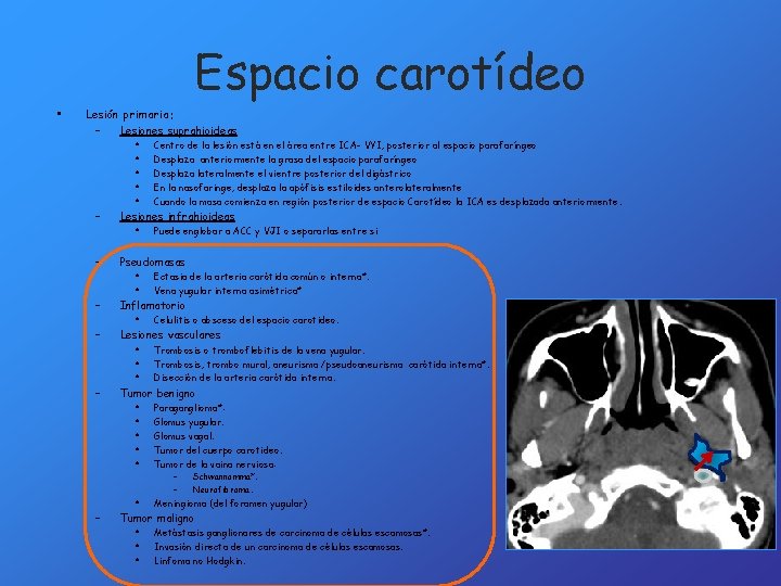 Espacio carotídeo • Lesión primaria: – Lesiones suprahioideas – – – • • •