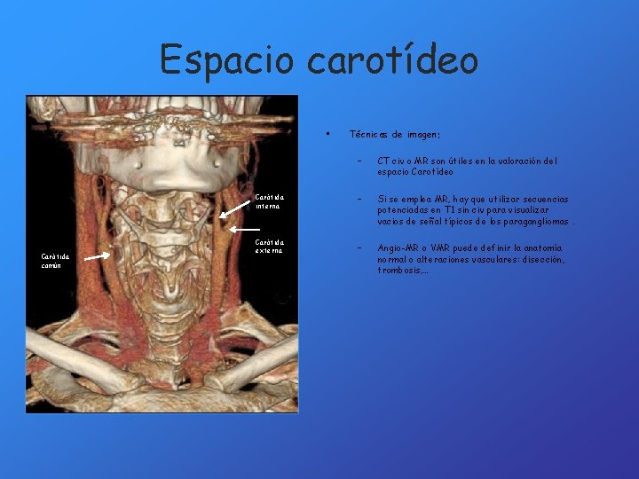Espacio carotídeo • Carótida común Técnicas de imagen: – CT civ o MR son