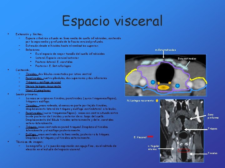 Espacio visceral • • Extensión y límites: – Espacio cilíndrico situado en línea media