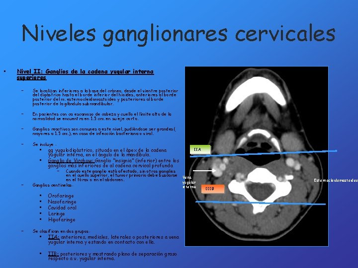 Niveles ganglionares cervicales • Nivel II: Ganglios de la cadena yugular interna superiores –