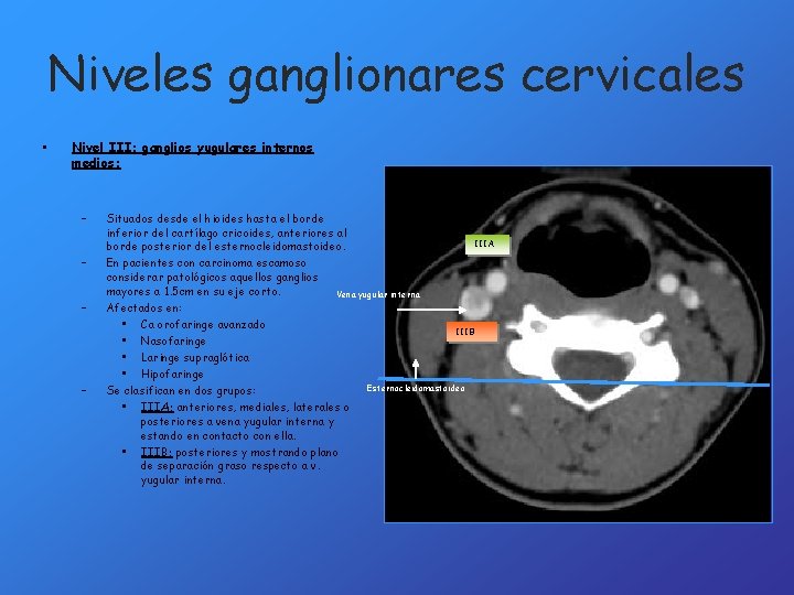 Niveles ganglionares cervicales • Nivel III: ganglios yugulares internos medios: – – Situados desde