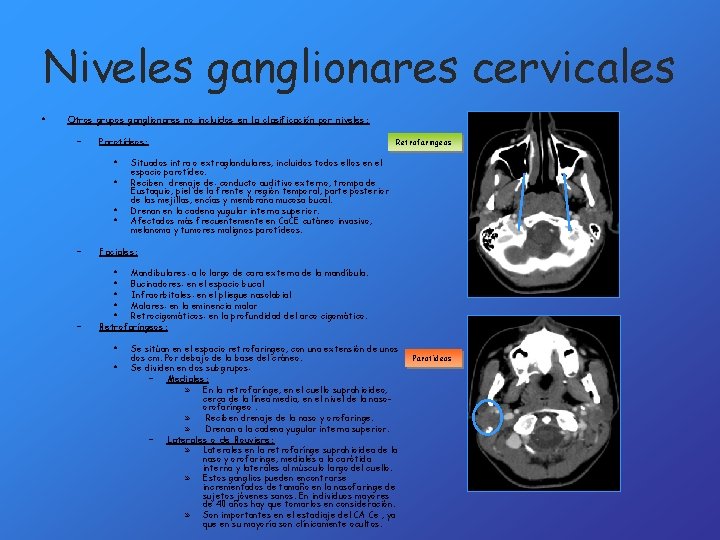Niveles ganglionares cervicales • Otros grupos ganglionares no incluidos en la clasificación por niveles: