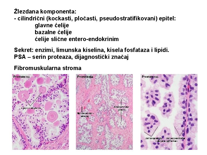 Žlezdana komponenta: - cilindrični (kockasti, pločasti, pseudostratifikovani) epitel: glavne ćelije bazalne ćelije slične entero-endokrinim