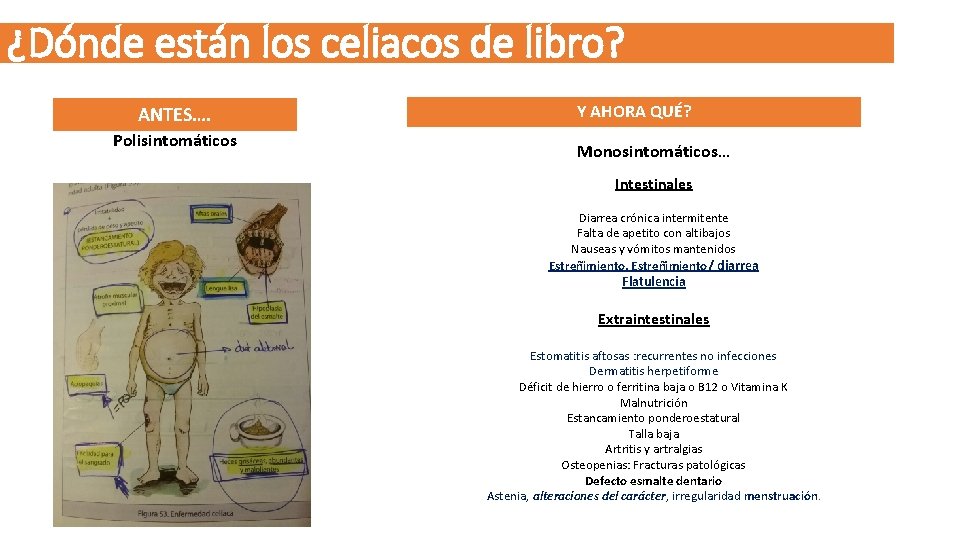 ¿Dónde están los celiacos de libro? ANTES…. Polisintomáticos Y AHORA QUÉ? Monosintomáticos… Intestinales Diarrea