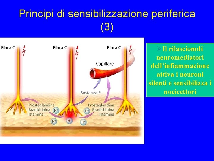 Principi di sensibilizzazione periferica (3) ØIl rilasciomdi neuromediatori dell’infiammazione attiva i neuroni silenti e