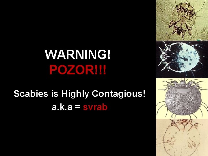 WARNING! POZOR!!! Scabies is Highly Contagious! a. k. a = svrab 